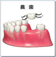 義歯